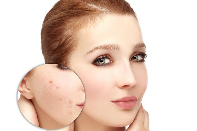 Skincare cho da mỏng yếu bằng việc bổ sung kem dưỡng phục hồi