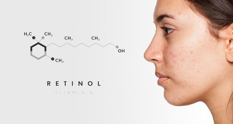 Retinol là dẫn xuất của Vitamin A thuộc nhóm Retinoid